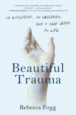 Beautiful trauma : an explosion, an obsession, and a new lease on life /