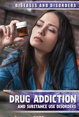 Drug addiction and substance use disorders /