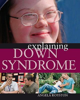 Explaining down syndrome /
