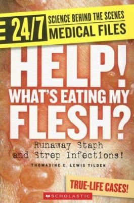 Help! what's eating my flesh? : runaway staph and strep infections! /