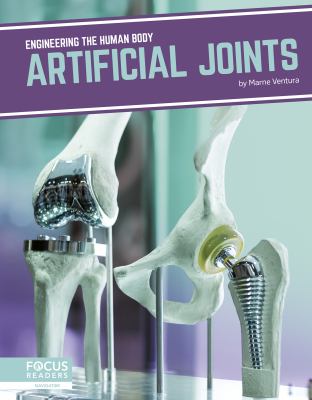 Artificial joints /